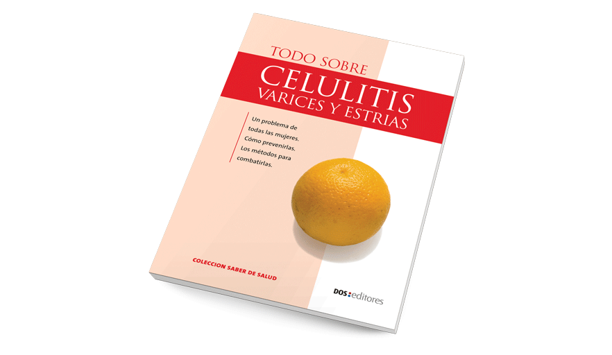 Celulitis, várices y estrías